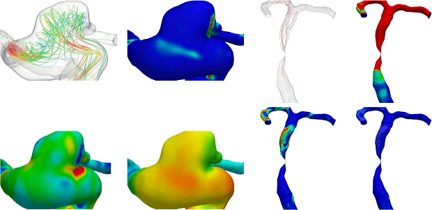 Preoperative