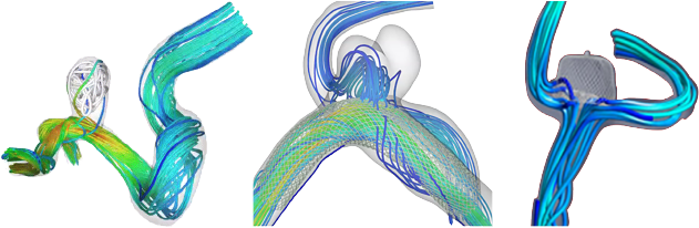 Postoperative